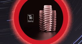 Nucleoss Implant Ege Biomedical